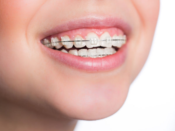 Chirurgie, orthodontie of trauma