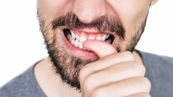 Nagelbijten; de tips en trucs om te stoppen!